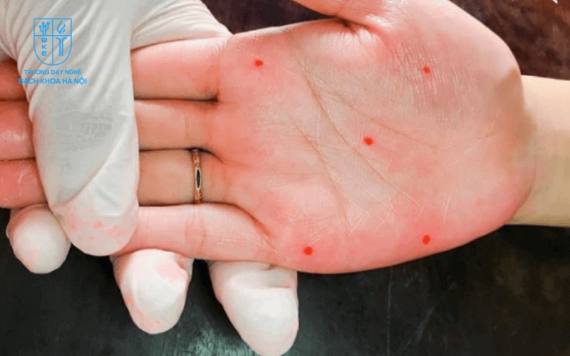 Xu hướng làm đẹp mới nổi khiến nhiều người tự hỏi có nên xăm nốt ruồi phong thủy không