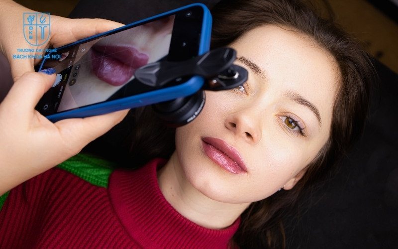 Từ 10 đến 14 ngày đầu là thời gian vàng để môi hồi phục