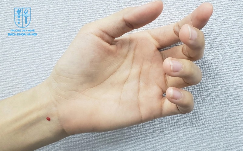 Nốt ruồi son tinh tế và tự nhiên trên cổ tay