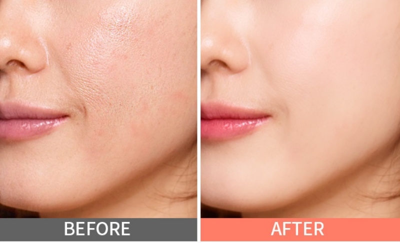 Kem nền Enprani Age Cover Lasting Veil Foundation