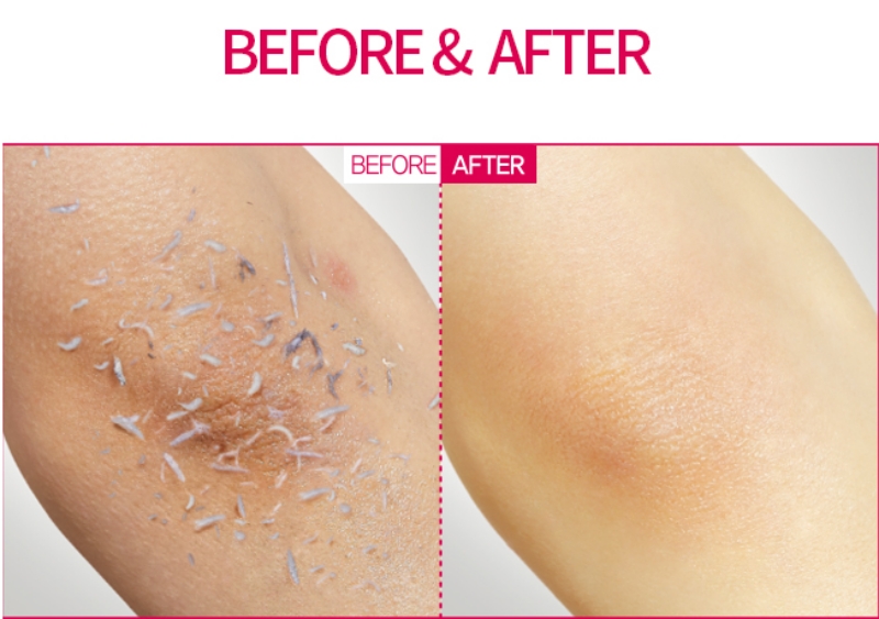 Tẩy Da Chết Body Enparni