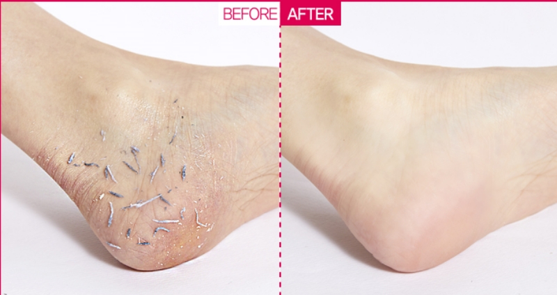 Tẩy Da Chết Body Enparni