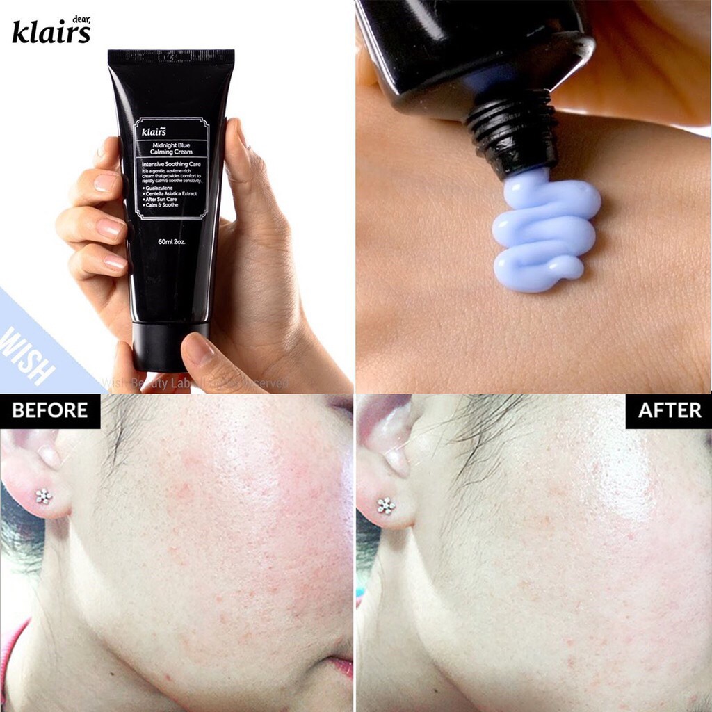 kem-duong-phuc-hoi-da-klairs-midnight-blue