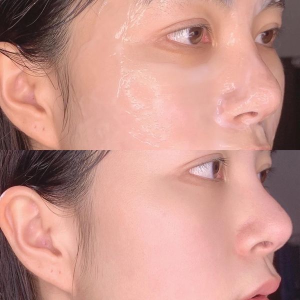 kem-duong-da-dau-mun-drg