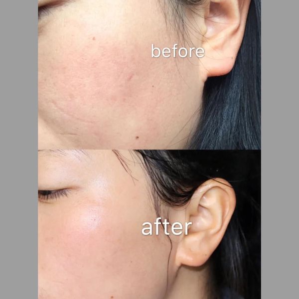 kem-duong-trang-olay-7-in-1