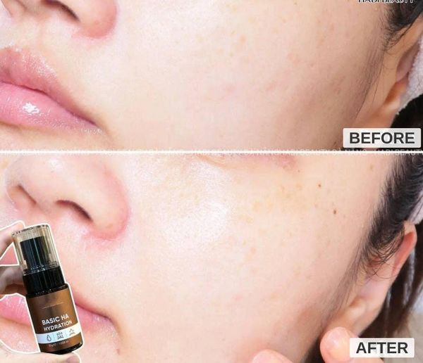 serum-duong-am-drceutics-ha