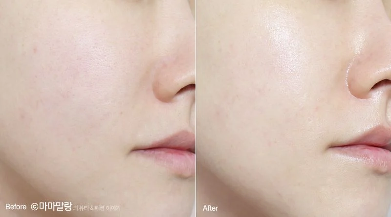 mat-na-bnbg-vita-genic