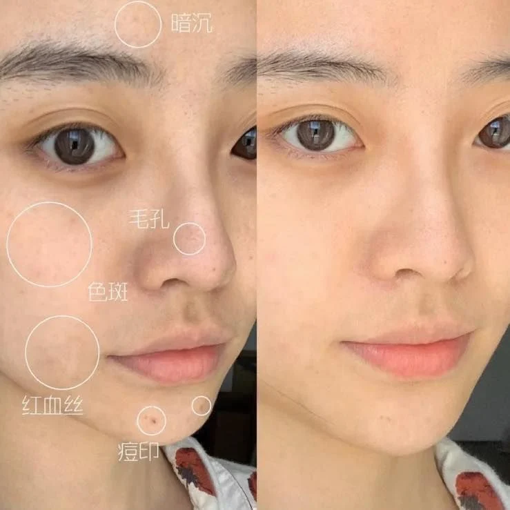 serum-cap-am-phuc-hoi-the-ordinary-Hyaluronic-b5