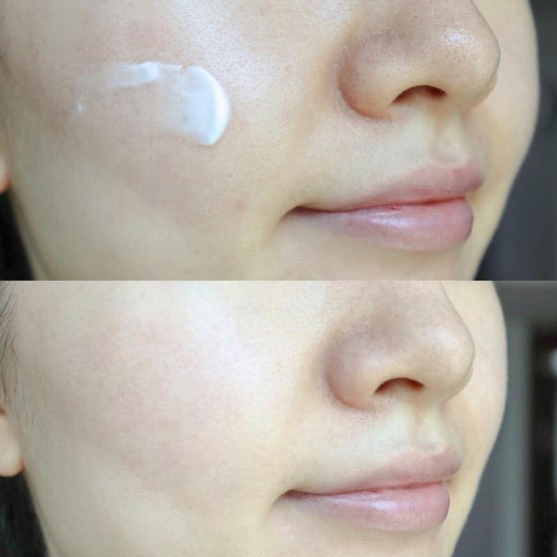 kem-duong-trang-medi-peel