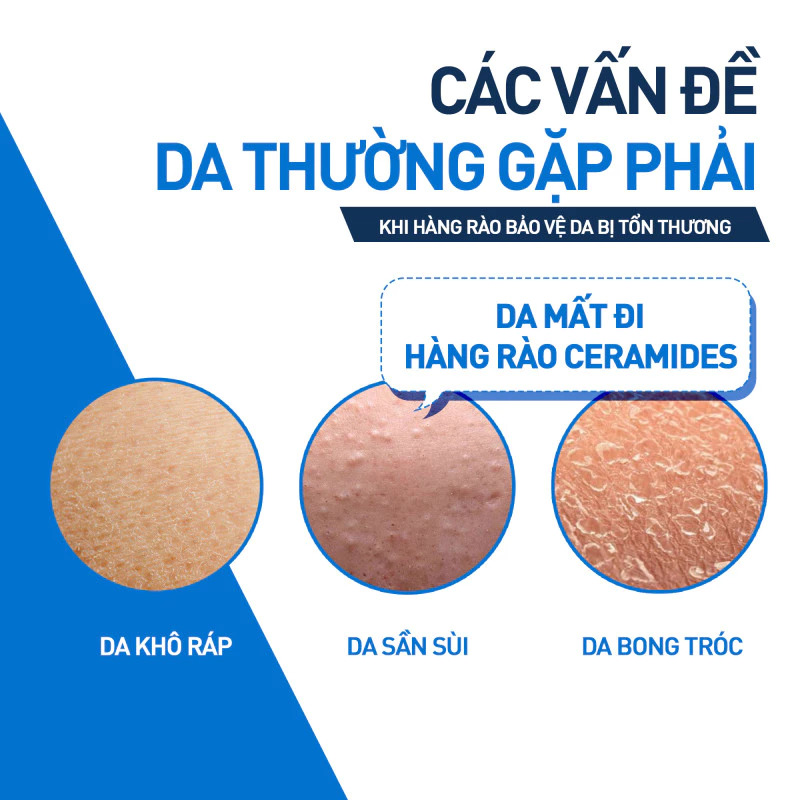 https://myphamkissme.com/kem-duong-am-cerave-moisturizing-cream