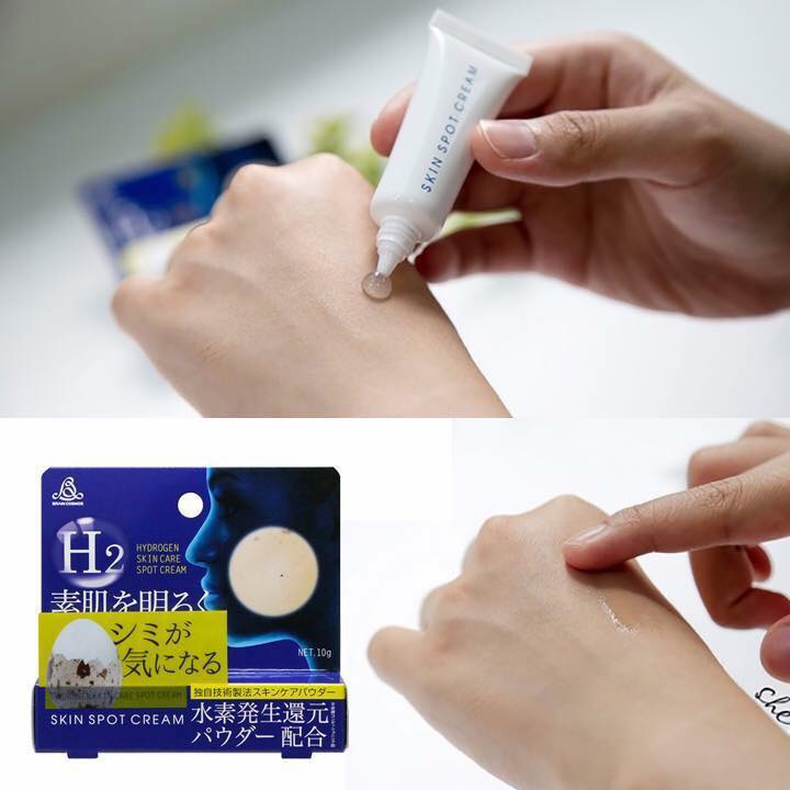 cách trị nám tàn nhang hiệu quả ở phụ nữ