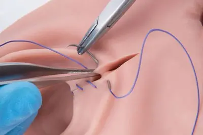 Âm Đạo Tái Tạo Có Giống Âm Đạo Thật Không? Sự Khác Biệt Chính Là Gì?