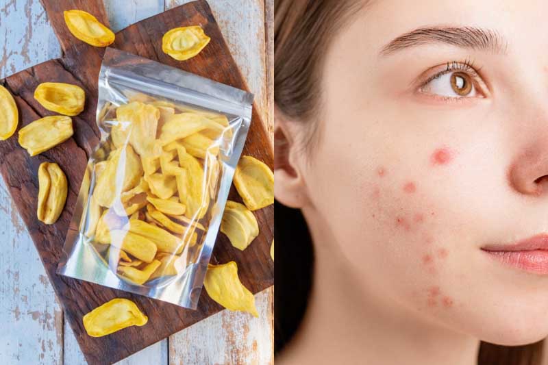 Liệu Ăn Mít Có Khiến Da Bạn Bị Mụn? Phân Tích Tác Động Từ Dinh Dưỡng