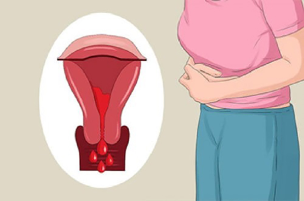 Bị Rong Kinh Sau Khi Quan Hệ: Chảy Máu Bình Thường Hay Dấu Hiệu Bệnh Phụ Khoa?