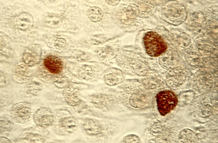 Bệnh Chlamydia Có Chữa Được Không? Cách Phòng Chống Hiệu Quả Từ Chuyên Gia
