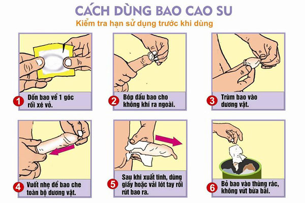 Hướng Dẫn Chi Tiết Cách Đeo Và Tháo Bao Cao Su Đúng Cách
