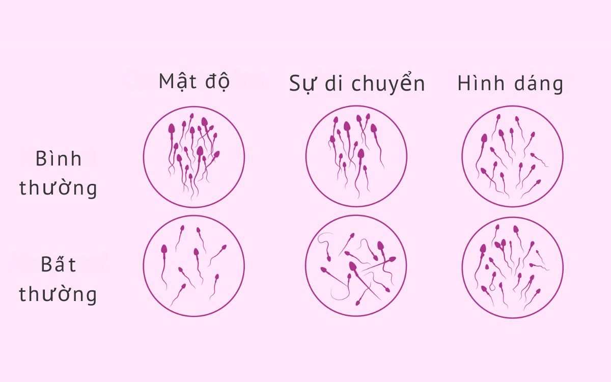 Mật Độ Tinh Trùng Là Gì? Chỉ Số Quan Trọng Trong Tinh Dịch Đồ