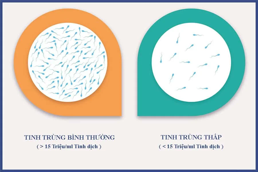 Mật Độ Tinh Trùng Là Gì? Chỉ Số Quan Trọng Trong Tinh Dịch Đồ