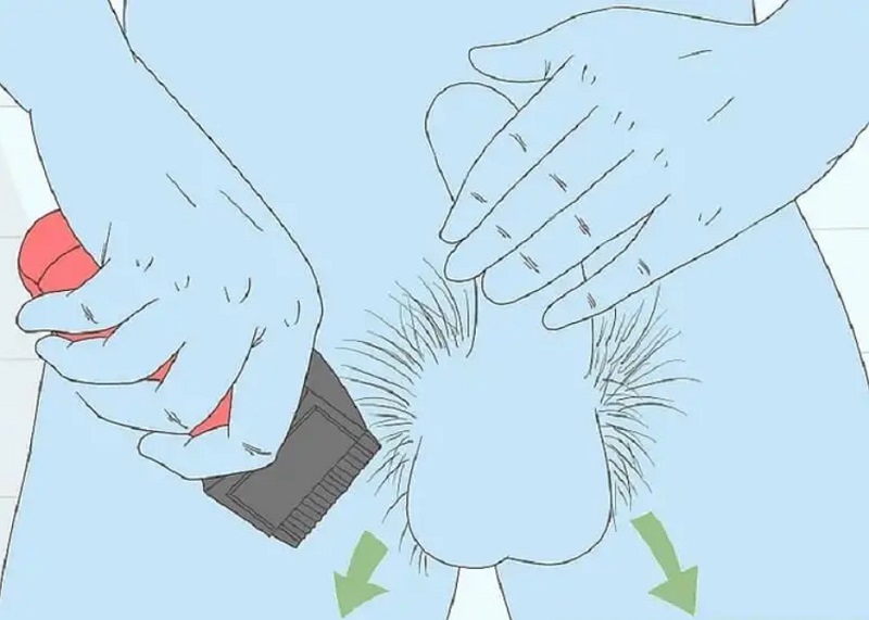 Nam Giới Có Nên Tỉa Lông Vùng Kín Không? Lợi Ích, Rủi Ro Và Cách Làm An Toàn