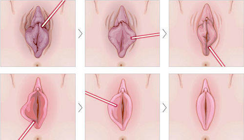 Nguyên Nhân Và Cách Khắc Phục Tình Trạng Môi Lớn Chảy Xệ An Toàn