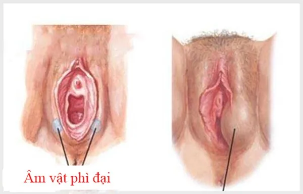 Nguyên Nhân Và Cách Khắc Phục Tình Trạng Môi Lớn Chảy Xệ An Toàn