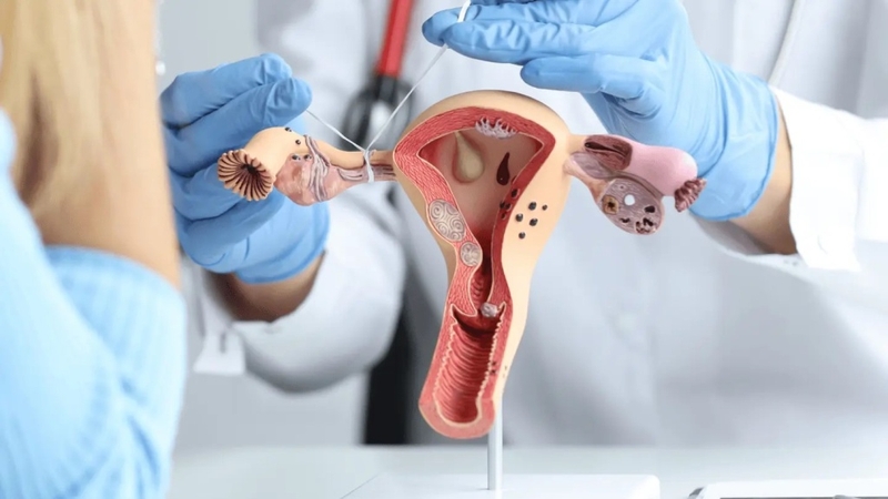 Thắt Ống Dẫn Trứng Là Gì? Lợi Ích, Rủi Ro Và Những Lưu Ý Quan Trọng