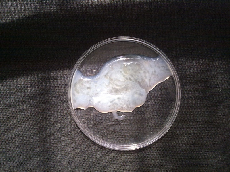 Thủ Dâm Nhiều Có Gây Vô Sinh Không? Giải Đáp Chính Xác Theo Khoa Học