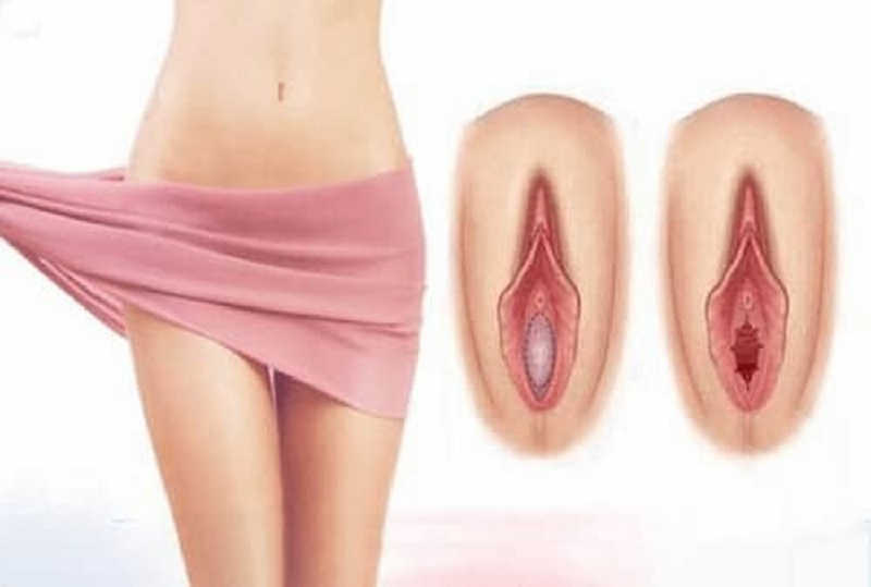 Không Có Màng Trinh Có Sao Không? Ảnh Hưởng Gì Đến Sức Khỏe & Sinh Sản? Giải Đáp Chi Tiết Từ Bác Sĩ