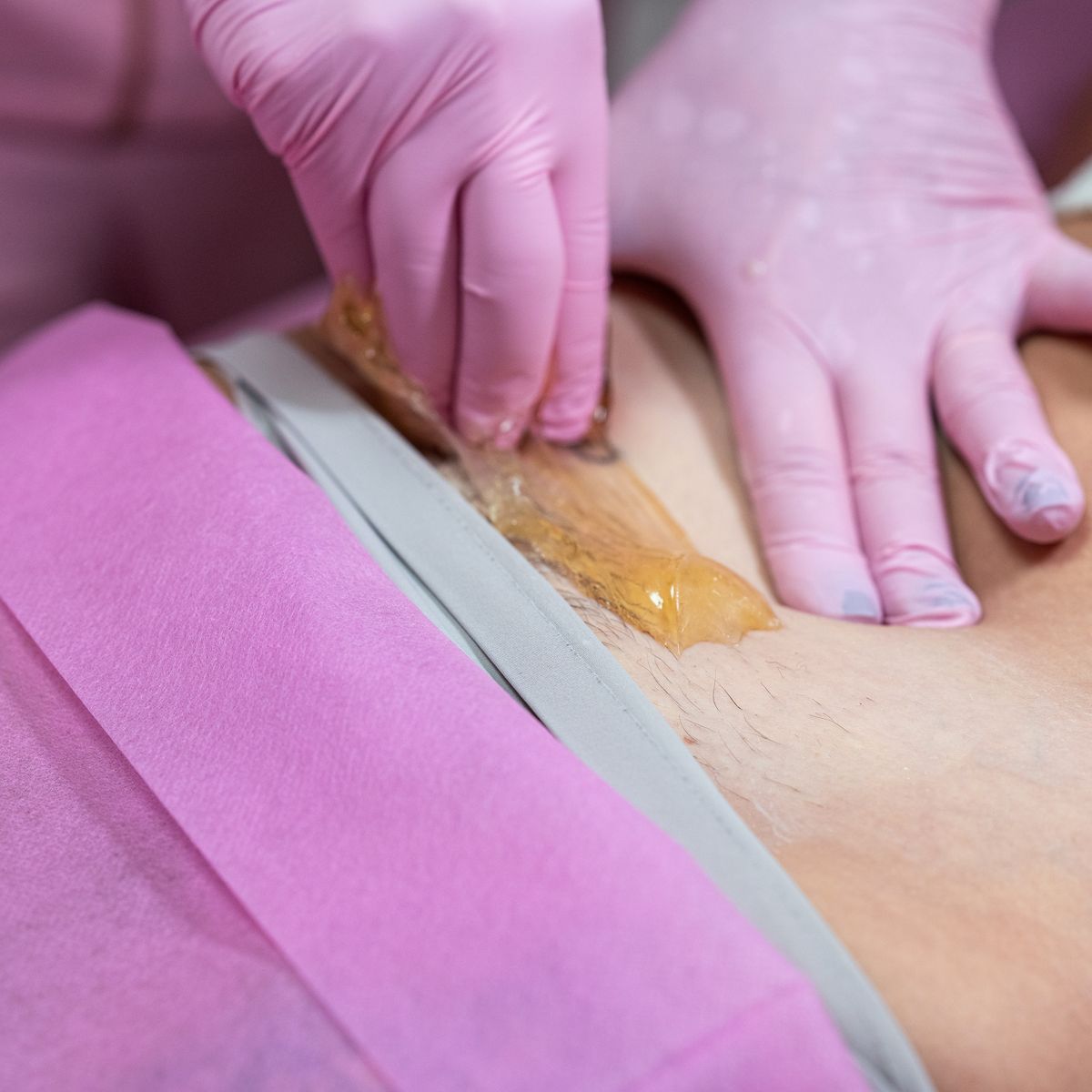 Wax vùng kín: Giải pháp làm đẹp sạch sẽ hay nỗi ám ảnh đau rát?