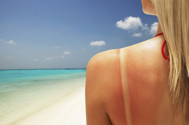 Vào mùa hè ánh nắng gây gắt có thể làm tổn thương làn da của bạn vì vậy đừng quên chăm sóc da cẩn thận nhé!