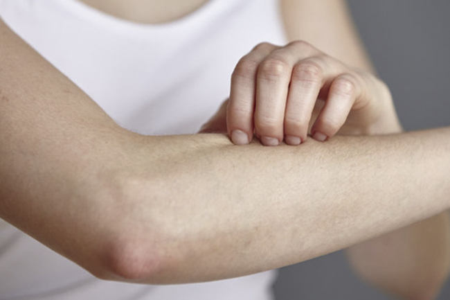 Hãy chuẩn bị sẵn thuốc trong vali du lịch đừng để mất vui khi bạn bị mẫn ngứa do vi khuẩn nhé!