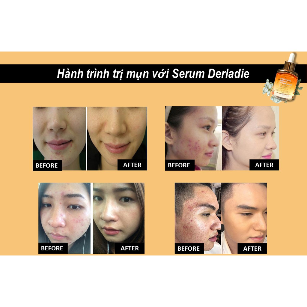 Serum Derladie Witch Hazel Perfect Vitamin 35ml