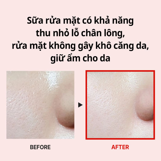 Sữa Rửa Mặt Dưỡng Ẩm Se Khít Lỗ Chân Lông Medi Peel+ Red Lacto Collagen Clear 2.0 300ml