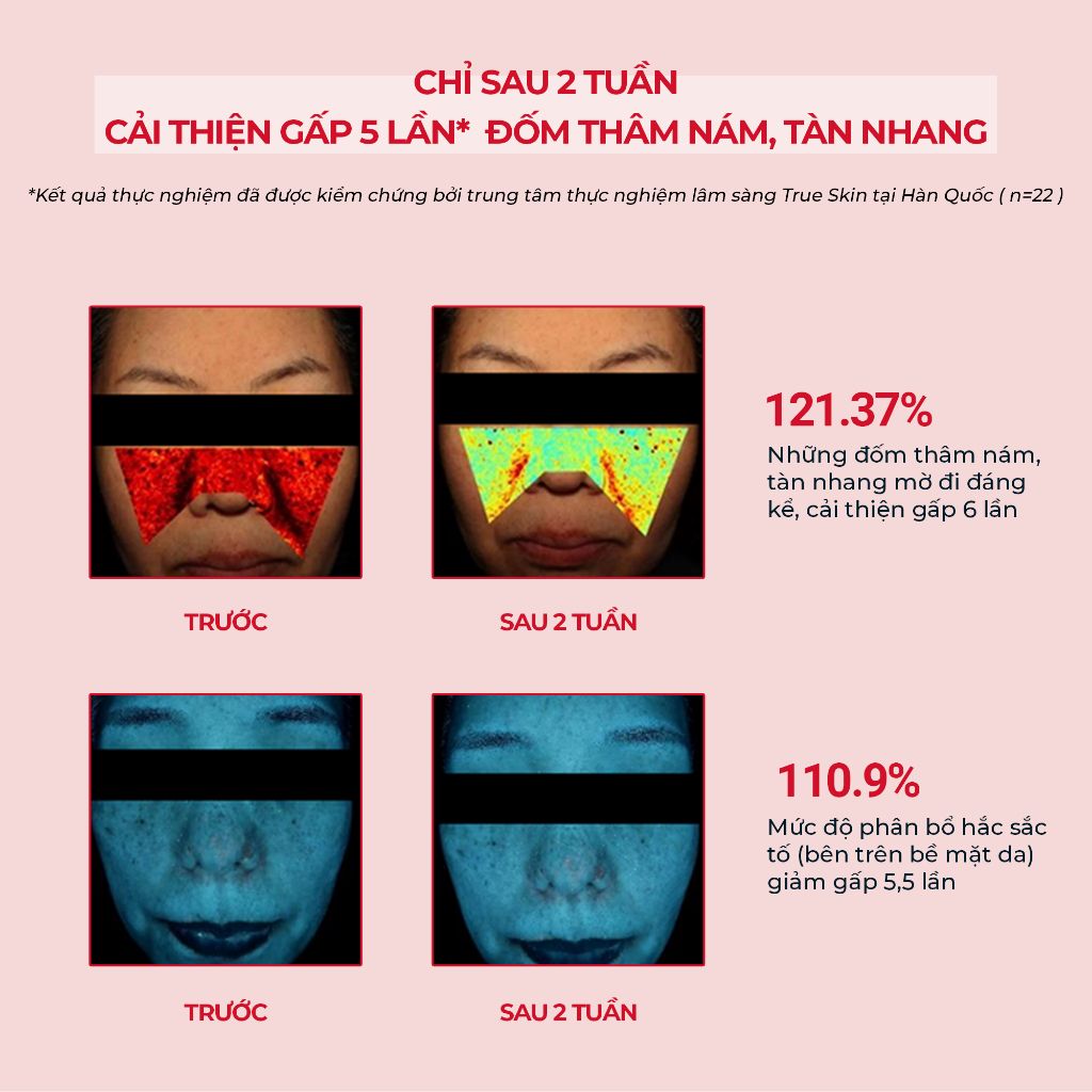 Nước Hoa Hồng Angel's Liquid Tranexamic Mela Zero Toner 150ml