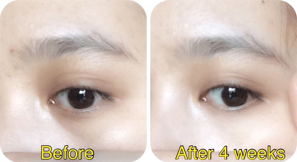 Lăn dưỡng mắt Simple Revitalising Eye 15ml