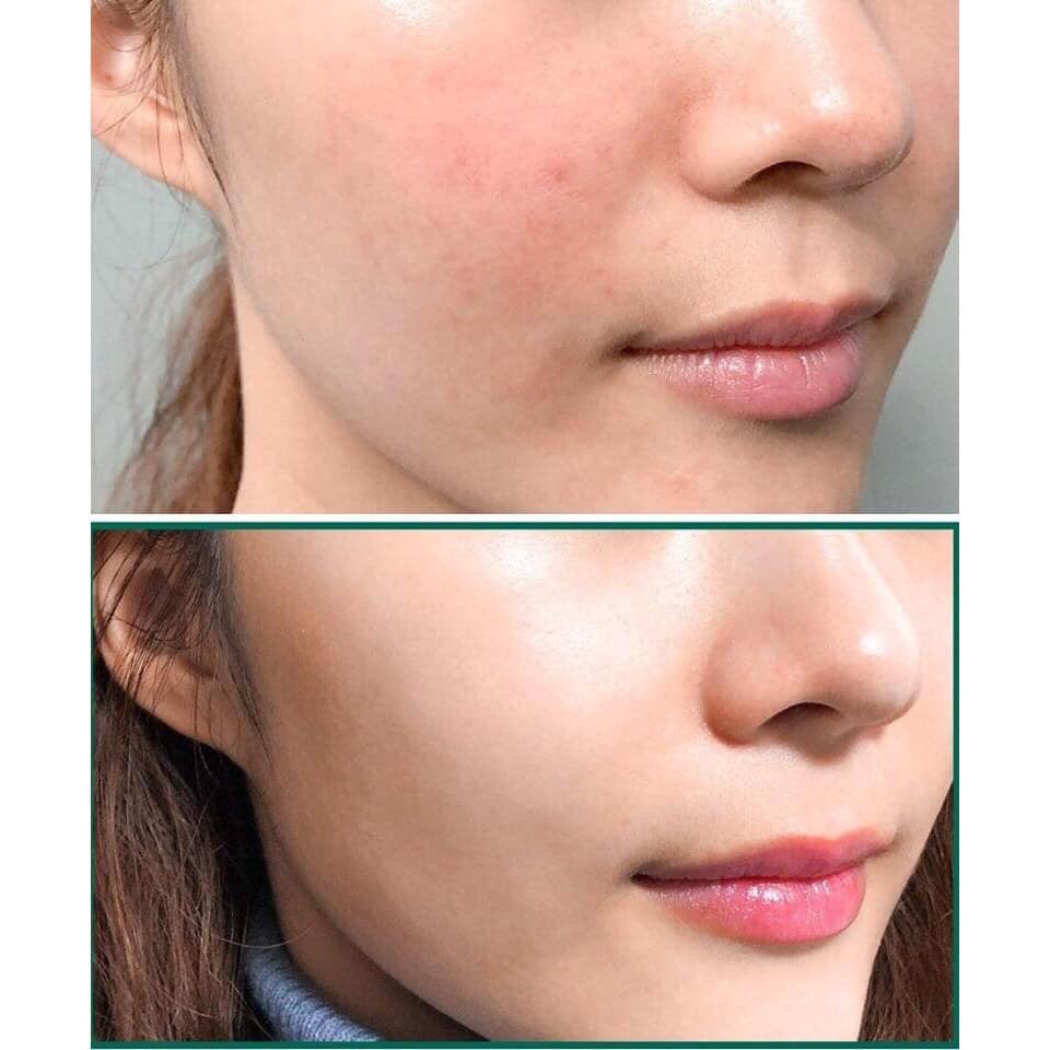 Kem Dưỡng Some By Mi Snail Truecica Miracle Repair 60g