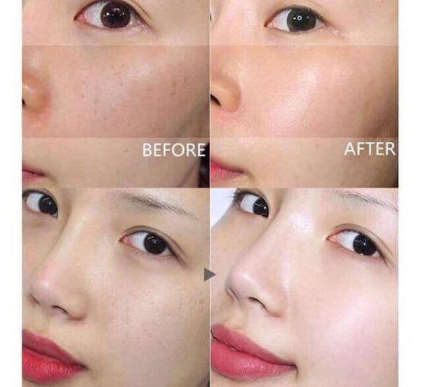 Nước Hoa Hồng Trị Nám Dongsung Rannce 130ml