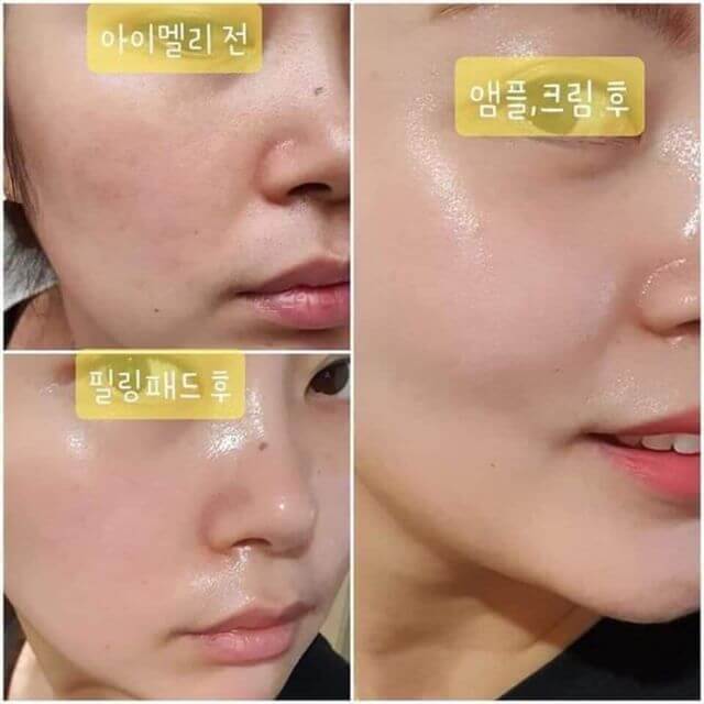 Tinh Chất Dưỡng Da JM Collagen Multi Vita Capsule Ampoule