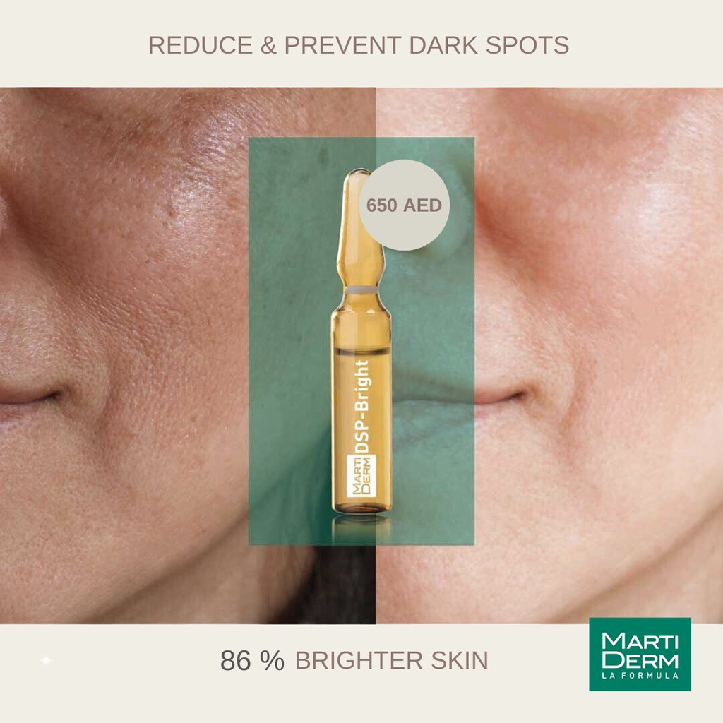 Tinh Chất MartiDerm Pigment Zero Dsp Bright 2ml