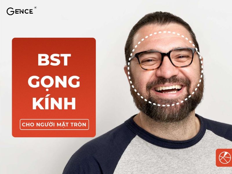 Gương mặt tròn với các đường nét mềm mại, tròn trịa