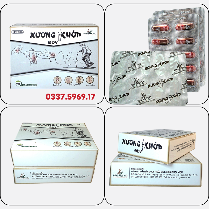 Xương Khớp ĐĐV điều trị thần kinh tọa