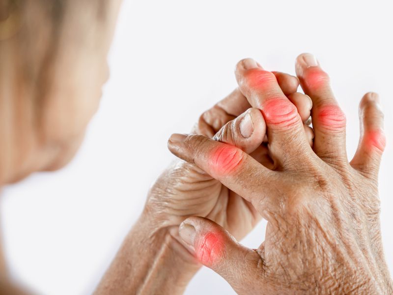 Nguyên nhân nào gây ra bệnh Gout ?