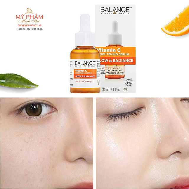 Serum C Balance 30ml dưỡng sáng da, mờ thâm - Anh Quốc giúp tẩy sạch tế bào chết, làm mờ đốm sắc tố, giảm thâm nám da. Tăng cường collagen giúp trẻ hóa làn da. Giúp thu nhỏ lỗ chân lông, làm sáng trắng da hiệu quả sau một thời gian ngắn.