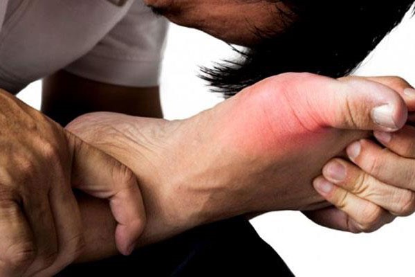 bệnh cơ xương khớp