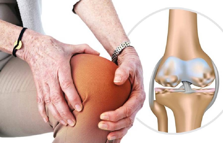 bệnh cơ xương khớp