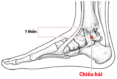 Huyệt Chiếu Hải loại bỏ các triệu chứng “dương thịnh, âm suy”