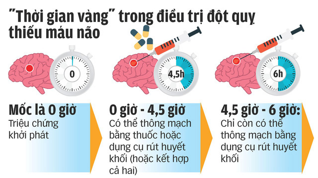 Mấu chốt trong quá trình điều trị bệnh nhân đột quỵ chính là thời gian