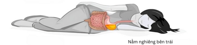 nằm nghiêng về phía bên trái để ngăn chặn những cơn ợ nóng