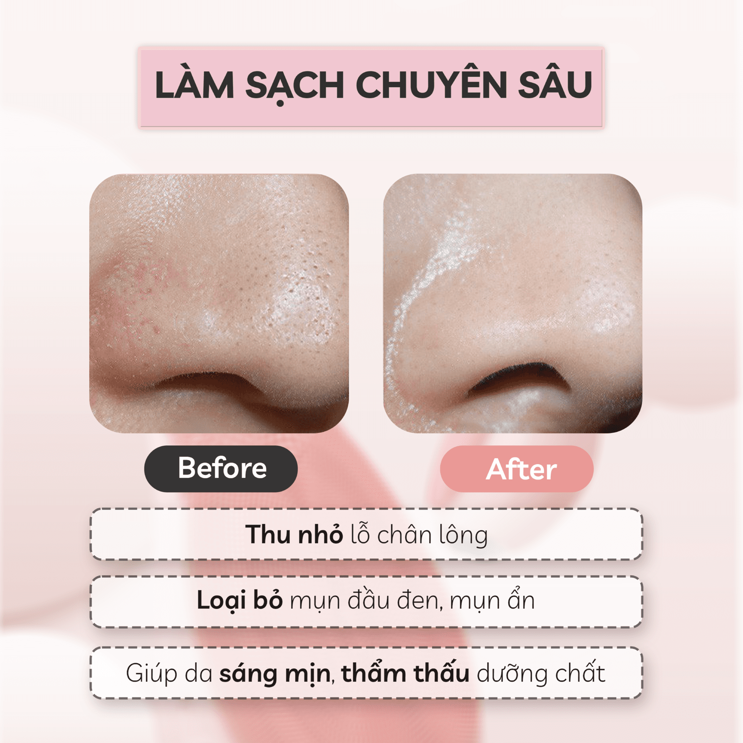 may-rua-mat-song-am-crenot-nia-p5