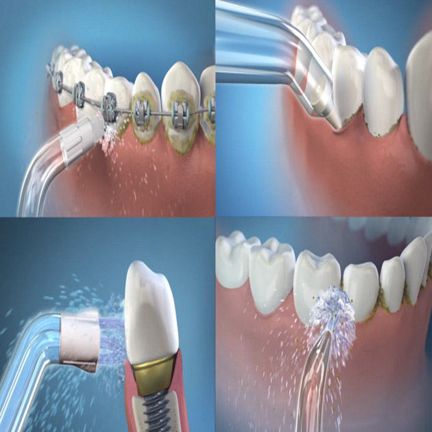 Lợi ích vượt trội của việc sử dụng máy tăm nước